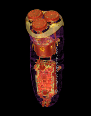 Illustration for article titled CT Scans of iPhone: Safer Than Exploratory Surgery